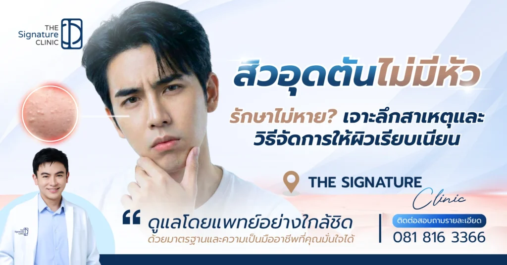 สิวอุดตันไม่มีหัว 1