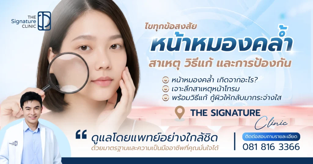 หน้าหมองคล้ำ 1