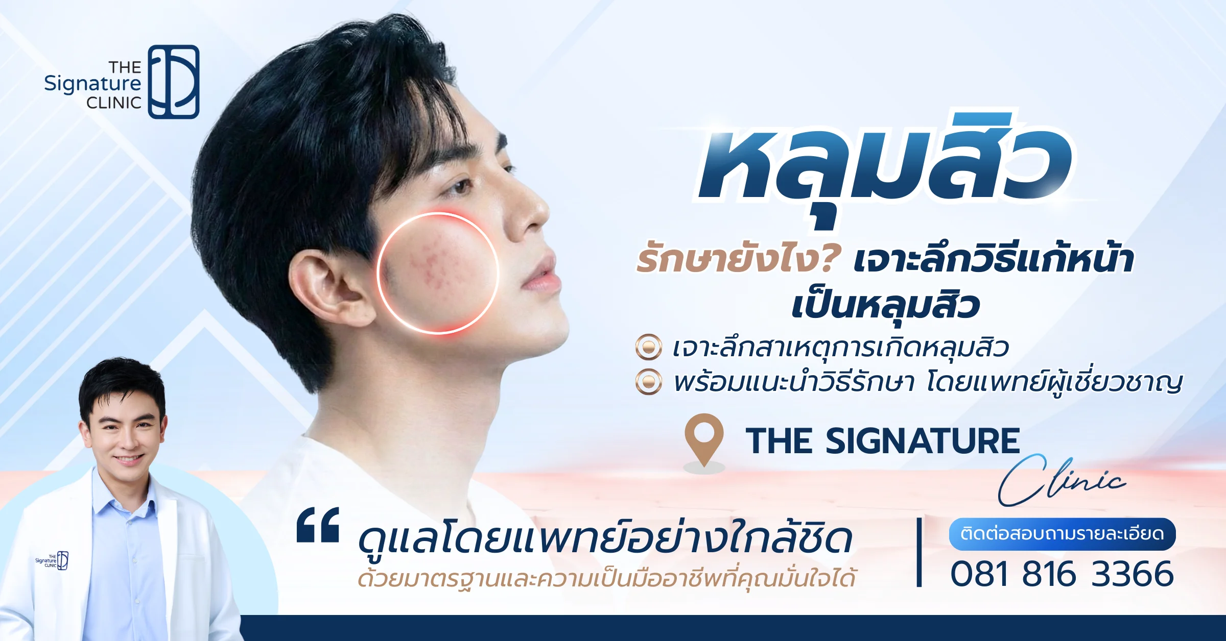 หลุมสิวรักษายังไง 1