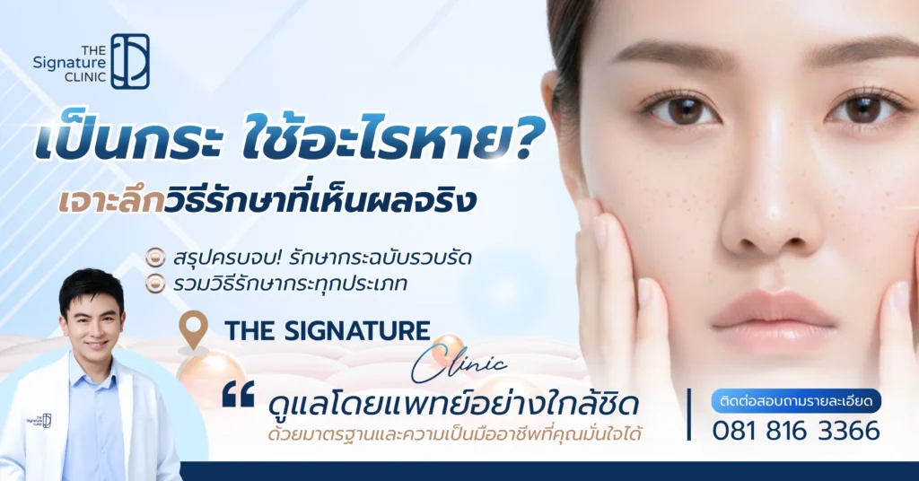 เป็นกระ ใช้อะไรหาย 1